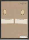 Navicula sp. (de-Toni-Nr.: Genus 1) Zeichnungen Sammlung Grunow Nr. 1659 (NHMW-BOT-W0368220)